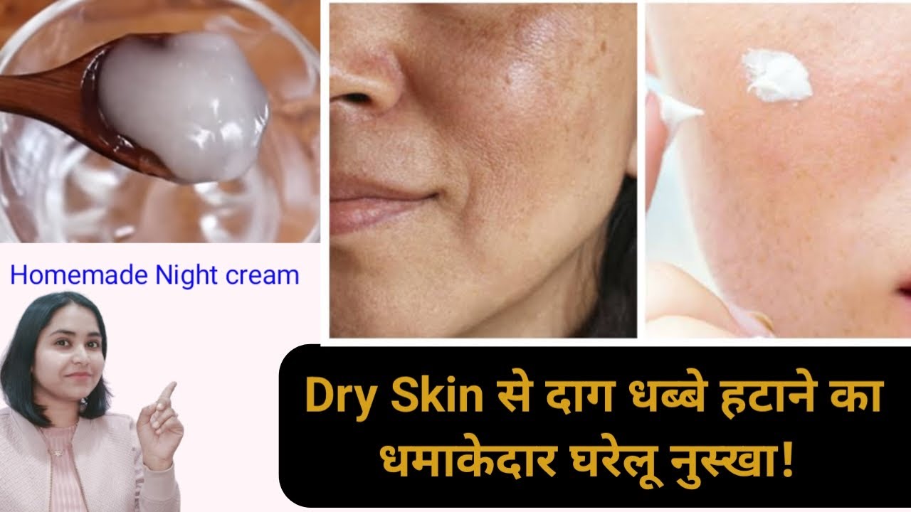 Pigmentation hatane ke liye home made night cream how to get glowing