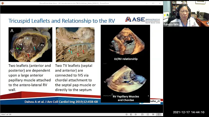 Part 2: Guidelines and Review of Tricuspid and Int...