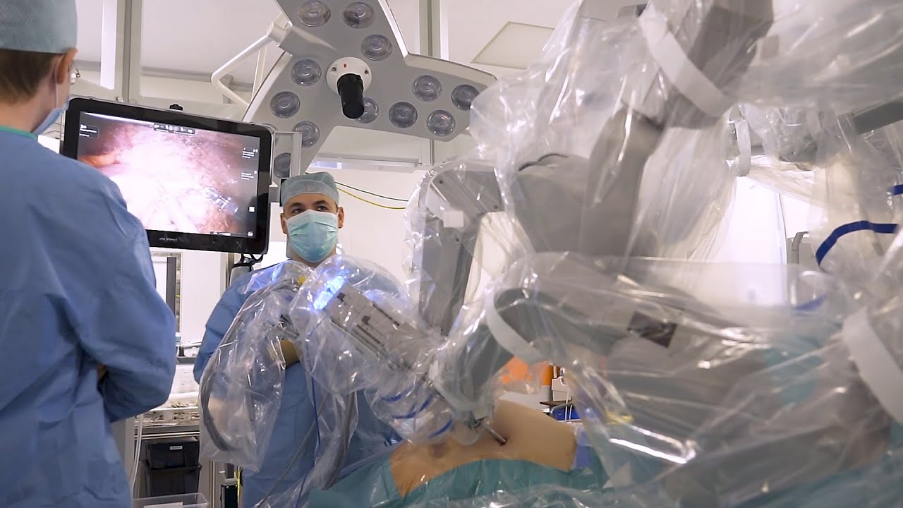 Робот-ассистированная рукавная резекция желудка (бариатрическая ...