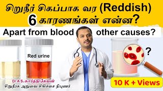 6 Reasons Why Urine Turns Red - Dr As Karthikeyan