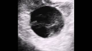 high resolution ultrasound