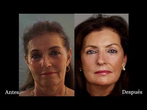 Como rejuvenecer 20 años en 7 dias sin cirugía con el Molding Mask
