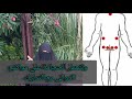 هل يمكن علاج دوالي الساقين بالحجامة أ سماخ الحصري 