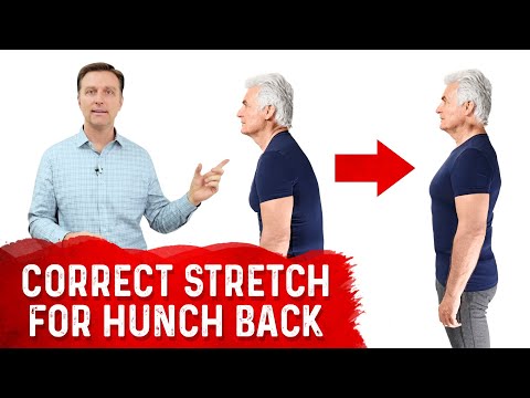 What How To Fix Scoliosis
