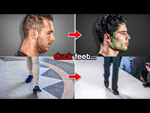 The Way You Walk Is Making You Ugly (Full Guide)