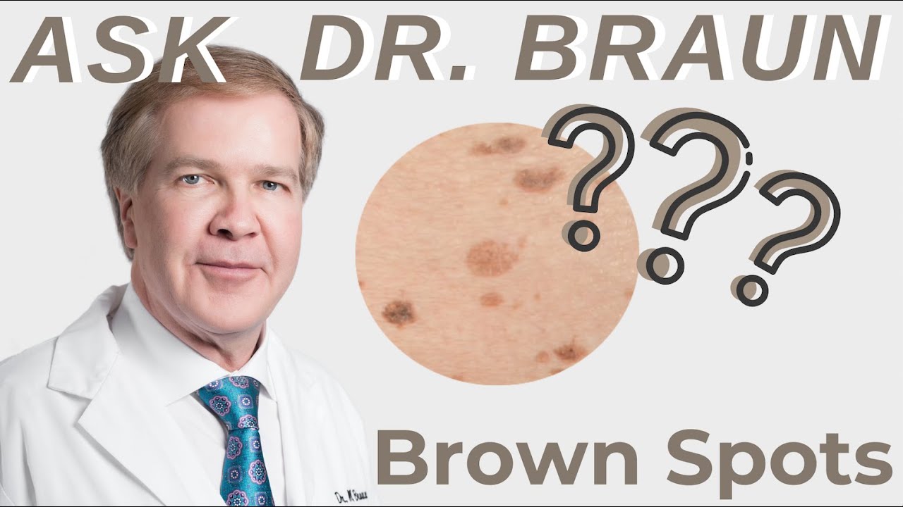 Ask Dr Braun Topic Brown Spots Youtube