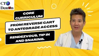 From Reverse CART to Antegrade Wire Access