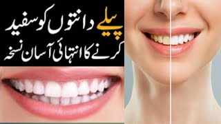 The Best Way to whiten teeth || Magical Teeth Whitening At Home || Effective Tips For Sensitive Gum