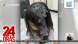 Batang Babae, Nadikitan Ng Slime Sa Buhok 24 Oras