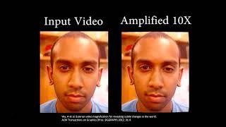 Brain Imaging at Mātai imaging centre and future application for Brain imaging