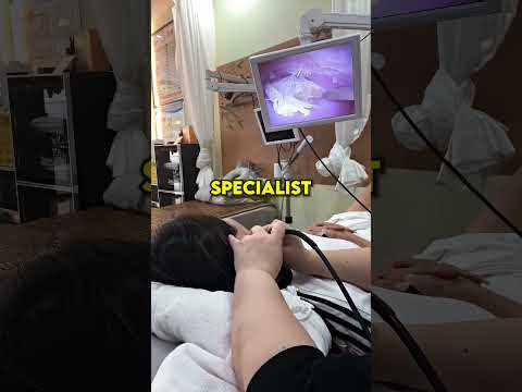 Doctor Cleaned Her Ears using a Tiny Camera 😲