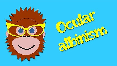 Ocular albinism | Gama Eye Care EN