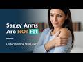 Saggy arms are not fat: the quiet sign of motor decline that demands a caregiver after 50