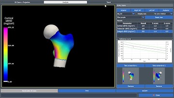 2020 06 DMS Imaging DXA HOW TO analysis 3D DXA