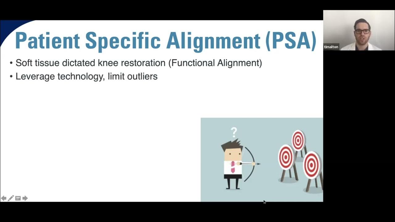 Dr. Timothy Alton PatientSpecific Alignment and Robotic Assisted TKA