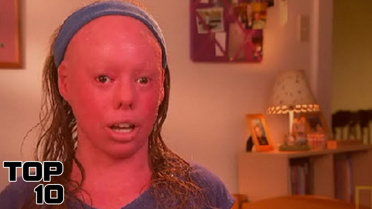 Top Ten Medical Mysteries - YouTube