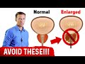 4 Things to Avoid if You Have an Enlarged Prostate – Dr.Berg