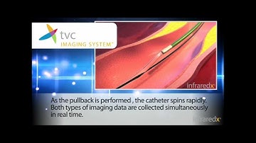 How the TVC Imaging System Works
