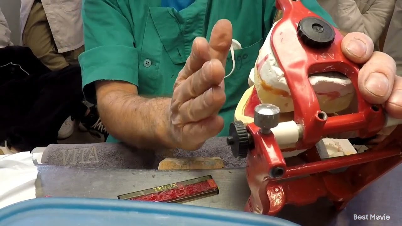 montaggio di una protesi totale inferiore lezione didattica d approccio