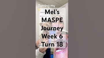 MASPE and diastema #maspe #marpe #airwayorthodontics #smallmouth #adultbraces