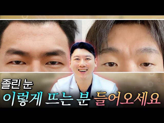 이마에 주름이 생기는 이유! 바로 눈 뜨는 근육 때문!
