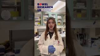 Illuminating the tissue barriers leading to treatment resistance and recurrence of bowel cancer