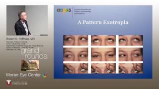 Pattern Strabismus