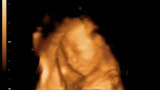 Bebe 21 Sedmici 10 Live