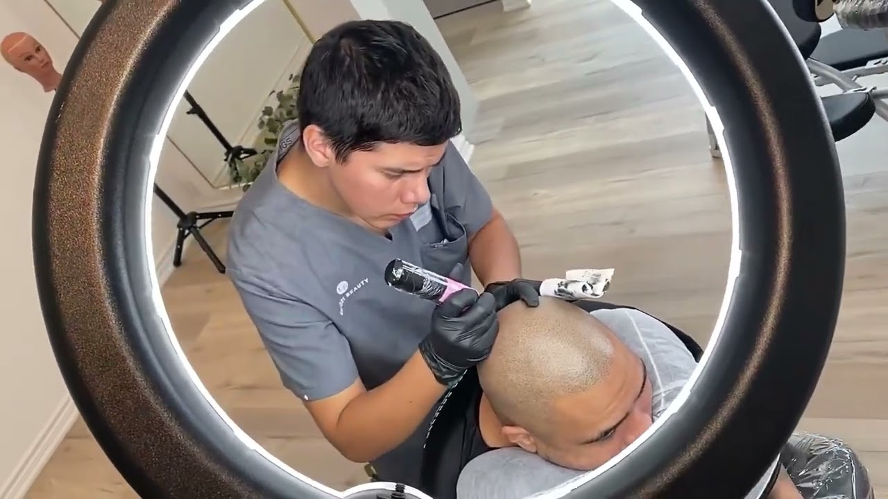 Best Hair Loss Clinic in Toronto,Unyozi Beauty!