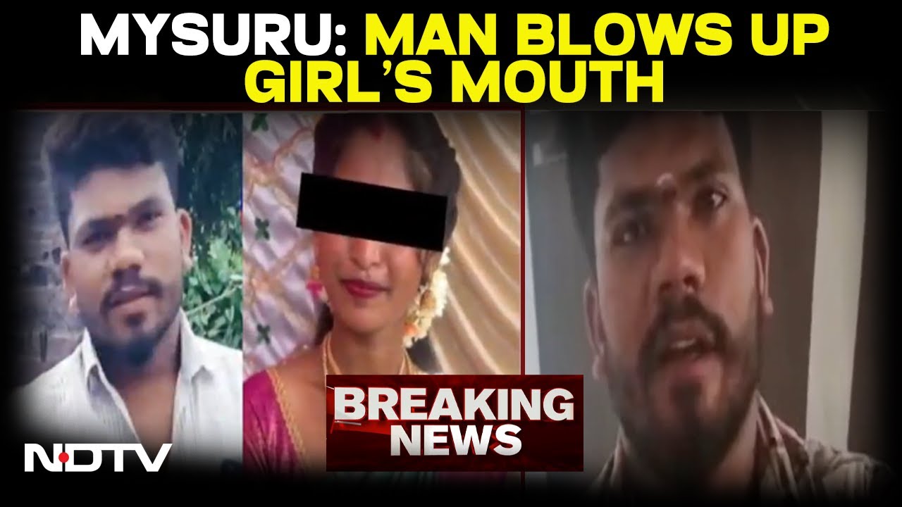Karnataka News | Karnataka Man Puts Explosive In Lover's Mouth, Sets It Off After Fight | Mysuru