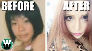 10 Most Extreme Plastic Surgeries You Wont Believe!