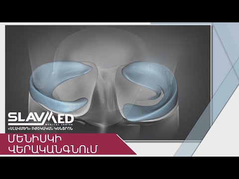 Video: Կուժի բույսը մեռնում է. սափոր բույսերի դարչնագույն կամ դեղնավուն պատճառները