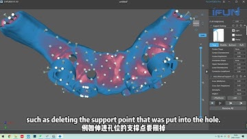 How To Print Ortho Surgical Guide with 3D Printer In Right Way