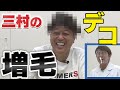 【増毛大作戦】三村のデコをあの頃に戻そう！