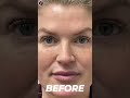 Exclusive Discounts at Dr. J Anti-Aging Clinic