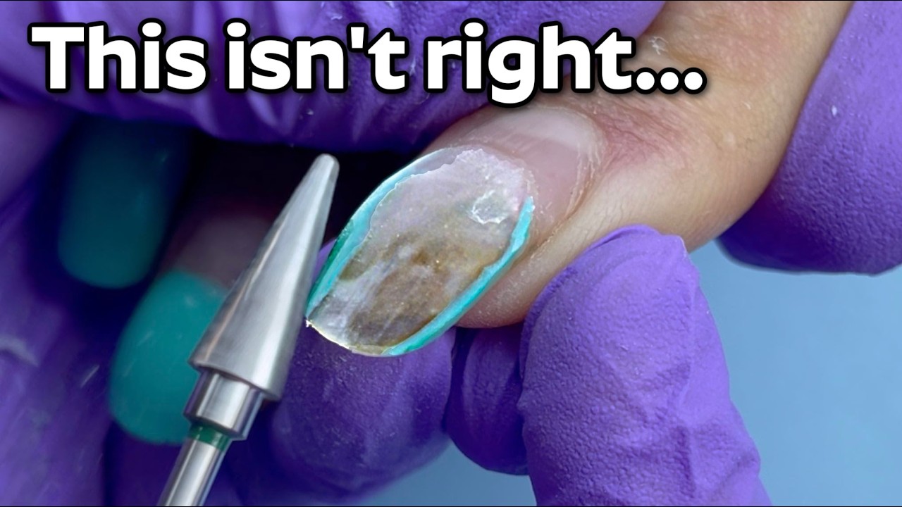 Gel Ruined Her Nails?! The Damage I Found Underneath