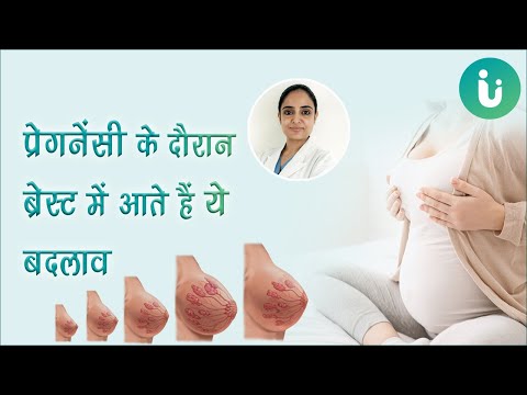 वीडियो: क्या मैं स्तनों में दर्द के बिना गर्भवती हो सकती हूं?