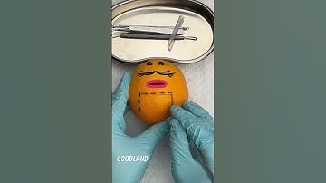 Thumbnail of Goodland | Operation on orange#goodland #Fruitsurgery #doodles #doodlesart #goodlandshor #animation