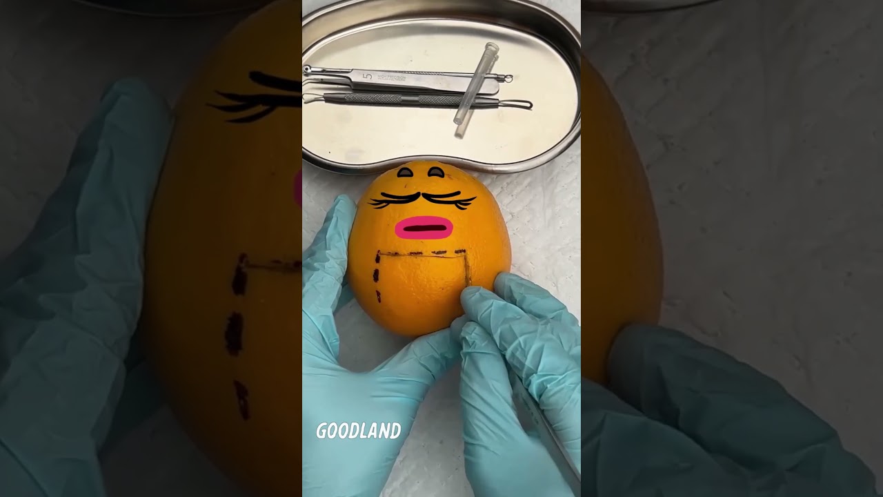 Goodland | Operation on orange