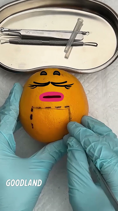 Goodland | Operation on orange#goodland #Fruitsurgery #doodles #doodlesart #goodlandshor #animation