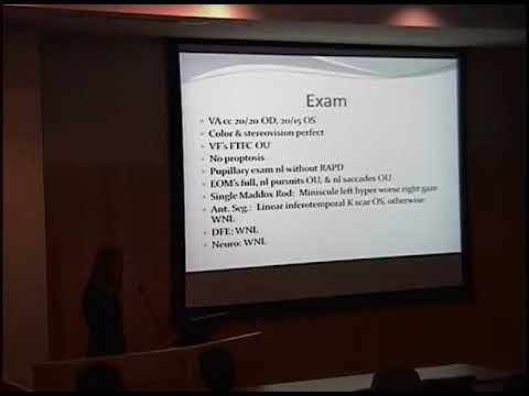 http://clinicaltrials.gov Flickering Movie Vision