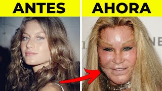 50 Famosos IRRECONOCIBLES Después de Cirugía Plástica | Antes y Después