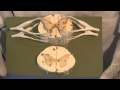 The Spinal Cord & Monosynaptic Reflex: Neuroanatomy Video Lab - Brain Dissections