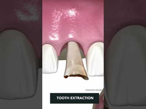 Видео: Кои зъби са кластик?