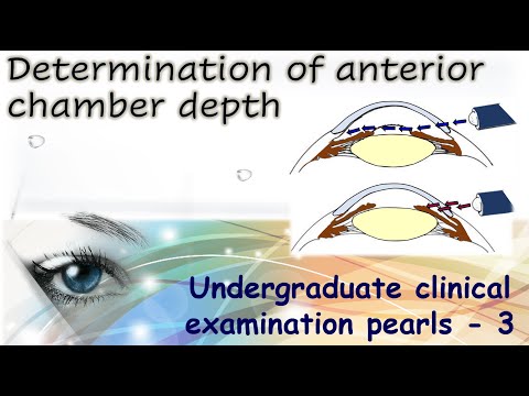 Determination of anterior chamber depth |Undergraduate Clinical Examination Pearls 3