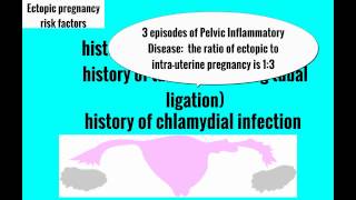 Topic 15: Ectopic Pregnancy