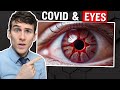 The SURPRISING Link Between Covid and Dry Eyes