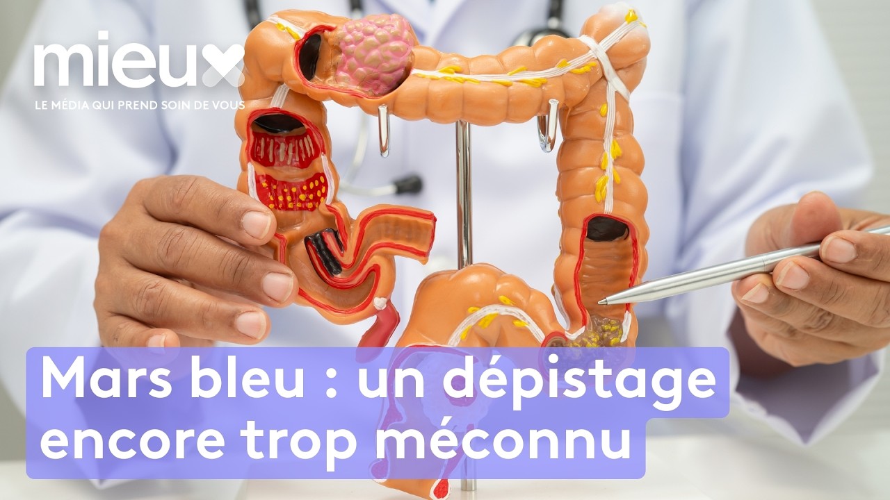 Cancer colorectal, pourquoi se faire dépister ? - Mieux ou Bien ?