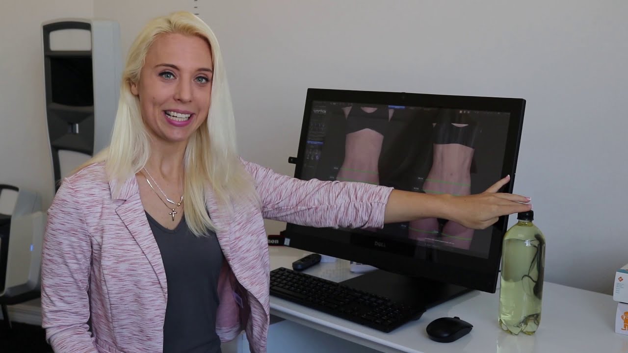 UltraSlim Treatment - Marissa Kaczmarek 2019 - Before & Afters