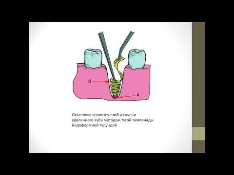 Основы хирургической стоматологии 1. Возможные осложнения после удаления зубов